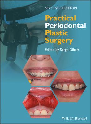 Practical Periodontal Plastic Surgery - Dibart, Serge (Editor)