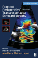 Practical Perioperative Transoesophageal Echocardiography: Text with CD-ROM - Bashein, Gary, MD, and Legget, Malcolm, MD, and Merry, Alan, MD