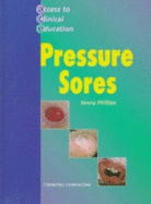 Pressure Ulcers