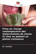 Prise en charge contemporaine des malocclusions de classe III chez un patient en pleine croissance