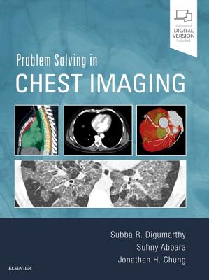 Problem Solving in Chest Imaging - Digumarthy, Subba R., and Abbara, Suhny, and Chung, Jonathan H.