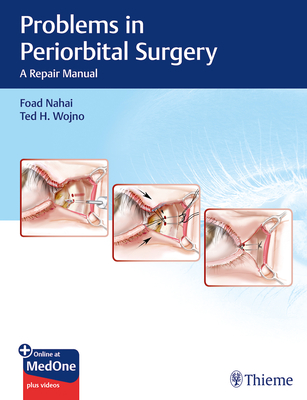 Problems in Periorbital Surgery: A Repair Manual - Nahai, Foad, and Wojno, Ted H