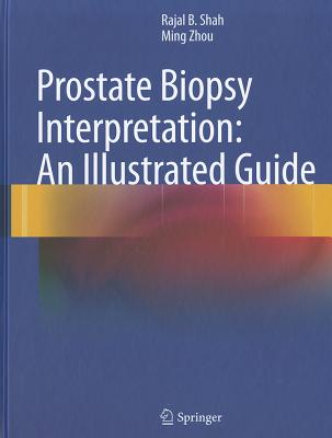 Prostate Biopsy Interpretation: An Illustrated Guide - Shah, Rajal B., and Zhou, Ming