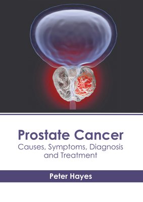 Prostate Cancer: Causes, Symptoms, Diagnosis and Treatment - Hayes, Peter (Editor)