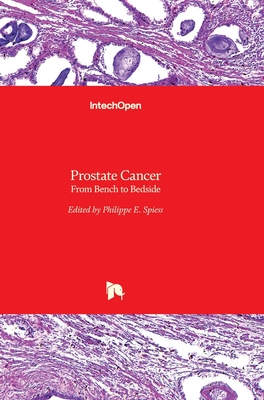 Prostate Cancer: From Bench to Bedside - Spiess, Philippe E (Editor)