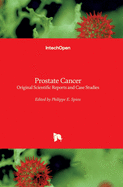 Prostate Cancer: Original Scientific Reports and Case Studies