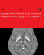 Quantitative Susceptibility Mapping: Magnetic Resonance Imaging of Tissue Magnetism