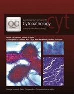 Quick Compendium Companion for Cytopathology: Challenge Questions for Cytopathology