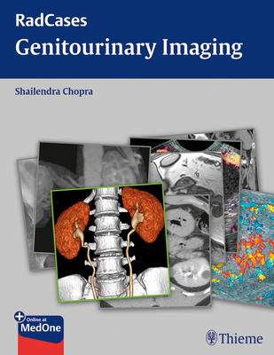 Radcases Genitourinary Imaging - Chopra, Shailendra