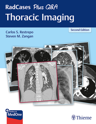 Radcases Plus Q&A Thoracic Imaging - Restrepo, Carlos S (Editor), and Zangan, Steven M (Editor)