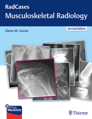 Radcases Q&A Musculoskeletal Radiology - Garcia, Glenn M (Editor)