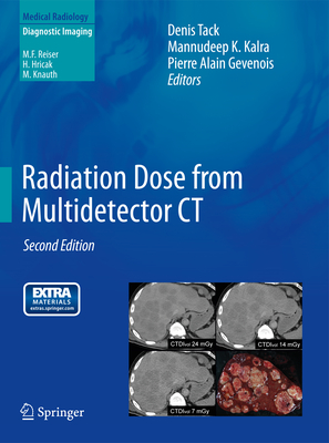 Radiation Dose from Multidetector CT - Tack, Denis (Editor), and Kalra, Mannudeep K (Editor), and Gevenois, Pierre Alain (Editor)