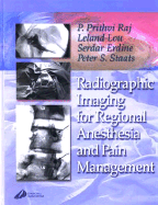 Radiographic Imaging for Regional Anesthesia and Pain Management