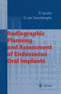 Radiographic Planning and Assessment of Endosseous Oral Implants - Jacobs, Reinhilde, and Steenberghe, Daniel Van