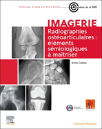 Radiographies ostoarticulaires : lments smiologiques  maitriser