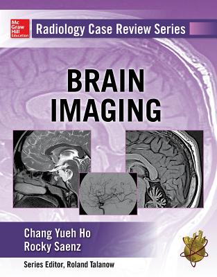 Radiology Case Review Series: Brain Imaging - Ho, Chang, and Saenz, Rocky