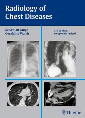 Radiology of Chest Diseases - Lange, Sebastian, and Walsh, Geraldine