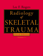 Radiology of Skeletal Trauma: 2-Volume Set