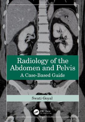 Radiology of the Abdomen and Pelvis: A Case-Based Guide - Goyal, Swati