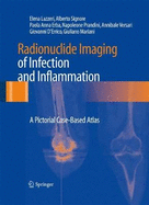 Radionuclide Imaging of Infection and Inflammation: A Pictorial Case-Based Atlas