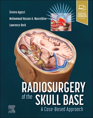 Radiosurgery of the Skull Base: A Case-Based Approach - Agazzi, Siviero, MD, MBA (Editor), and Berk, Lawrence (Editor), and Noureldine, Mohammad Hassan a (Editor)