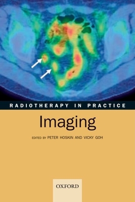 Radiotherapy in Practice - Imaging - Hoskin, Peter (Editor), and Goh, Vicky (Editor)