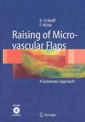 Raising of Microvascular Flaps: A Systematic Approach - Wolff, K -D, and Hvlzle, F, and Hc6lzle, F