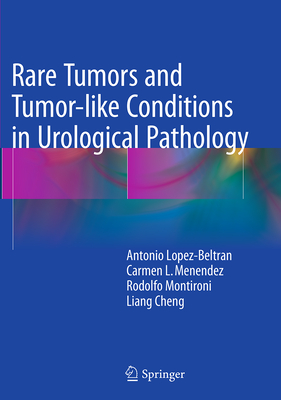 Rare Tumors and Tumor-Like Conditions in Urological Pathology - Lopez-Beltran, Antonio, and Menendez, Carmen L, and Montironi, Rodolfo