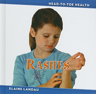 Rashes - Landau, Elaine