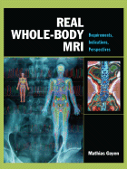 Real Whole-Body MRI: Requirements, Indications, Perspectives: Requirements, Indications, Perspectives