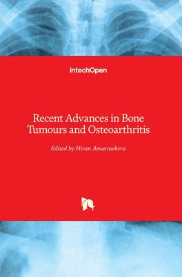 Recent Advances in Bone Tumours and Osteoarthritis - Amarasekera, Hiran (Editor)