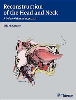 Reconstruction of the Head and Neck: A Defect-Oriented Approach - Genden, Eric M