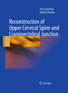 Reconstruction of Upper Cervical Spine and Craniovertebral Junction