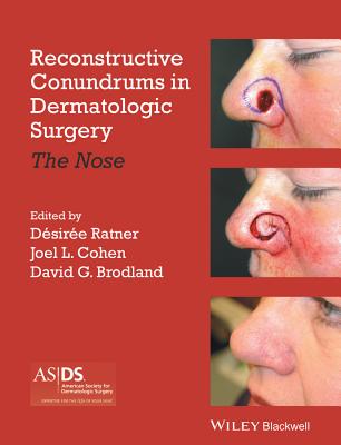 Reconstructive Conundrums in Dermatologic Surgery: The Nose - Ratner, Desiree S. (Editor), and Cohen, Joel L. (Editor), and Brodland, David (Editor)