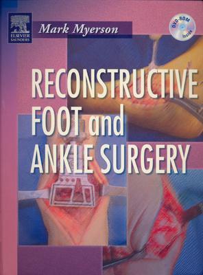 Reconstructive Foot and Ankle Surgery with DVD-ROM - Myerson, Mark S, MD