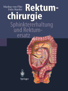 Rektumchirurgie: Sphinktererhaltung Und Rektumersatz