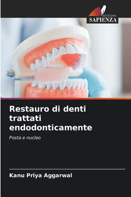 Restauro di denti trattati endodonticamente - Aggarwal, Kanu Priya