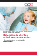 Retenci?n de dientes anteriores permanentes