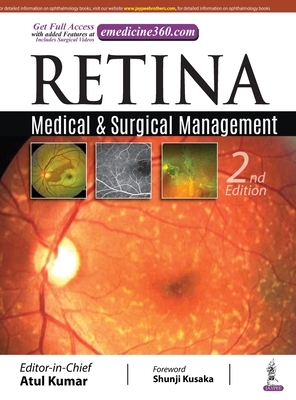 Retina: Medical & Surgical Management - Kumar, Atul