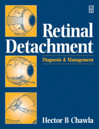 Retinal Detachment: Diagnosis and Management