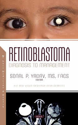 Retinoblastoma: Diagnosis to Management - Yadav, Sonal P. (Editor)