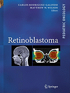 Retinoblastoma