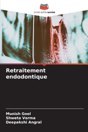 Retraitement endodontique