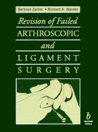 Revision of Failed Arthroscopic and Ligamentsurgery