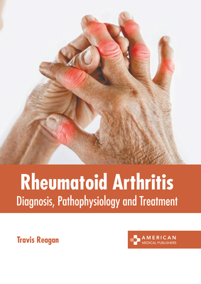 Rheumatoid Arthritis: Diagnosis, Pathophysiology and Treatment - Reagan, Travis (Editor)