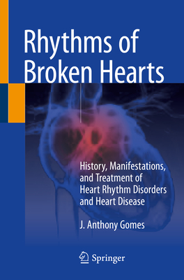 Rhythms of Broken Hearts: History, Manifestations, and Treatment of Heart Rhythm Disorders and Heart Disease - Gomes, J. Anthony