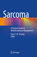 Sarcoma: A Practical Guide to Multidisciplinary Management