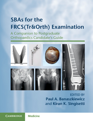SBAs for the FRCS(Tr&Orth) Examination: A Companion to Postgraduate Orthopaedics Candidate's Guide - Banaszkiewicz, Paul A. (Editor), and Singisetti, Kiran K. (Editor)