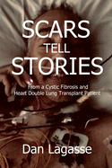 Scars Tell Stories: From a Cystic Fibrosis and Heart/Double Lung Transplant Patient