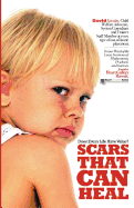 Scars That Can Heal: Does Every Life Have Value?